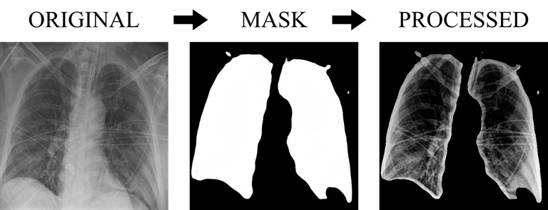 Raio x 1.png