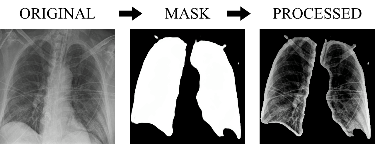 Raio x 1.png